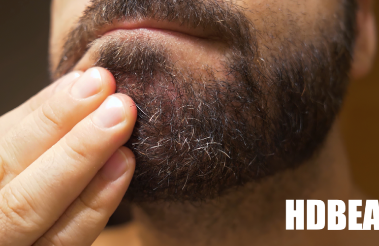 Beard Dandruff : “What causes it and how can I get rid of it?”