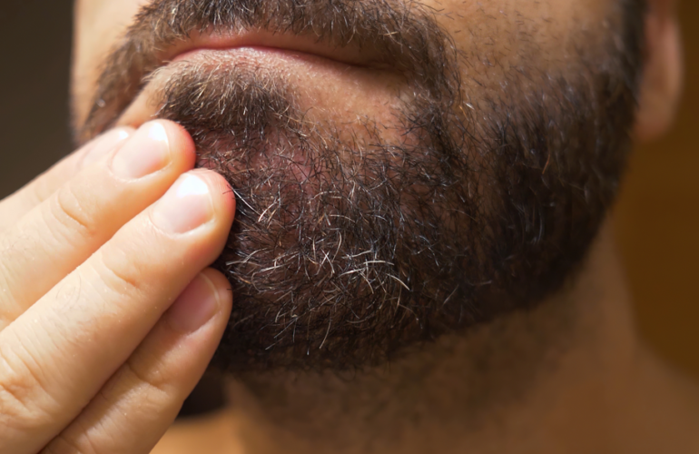 HD Beard Oil: Say Goodbye to Itch, Flakes, and Shine